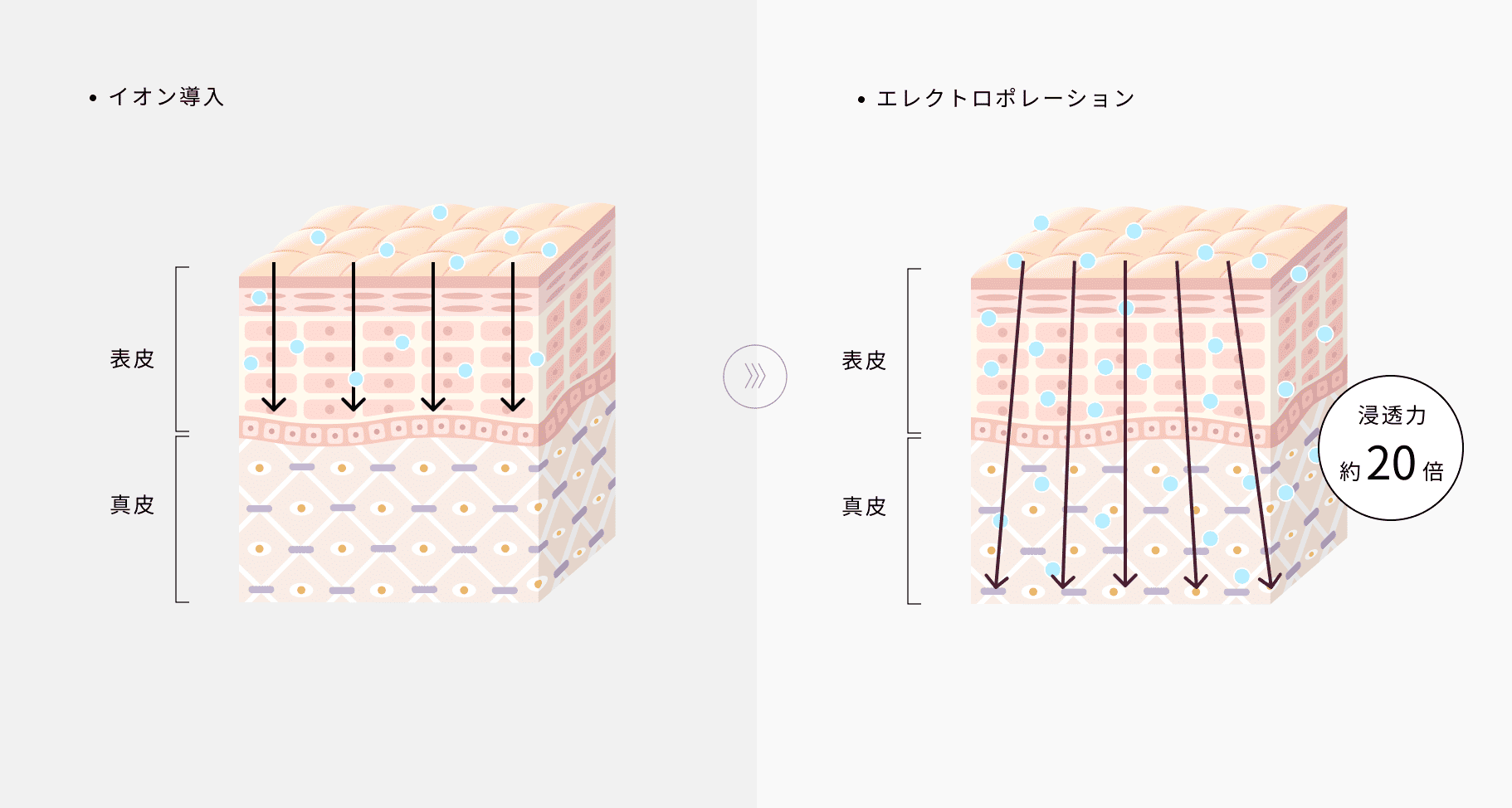 イオン導入 / エレクトロポレーション
